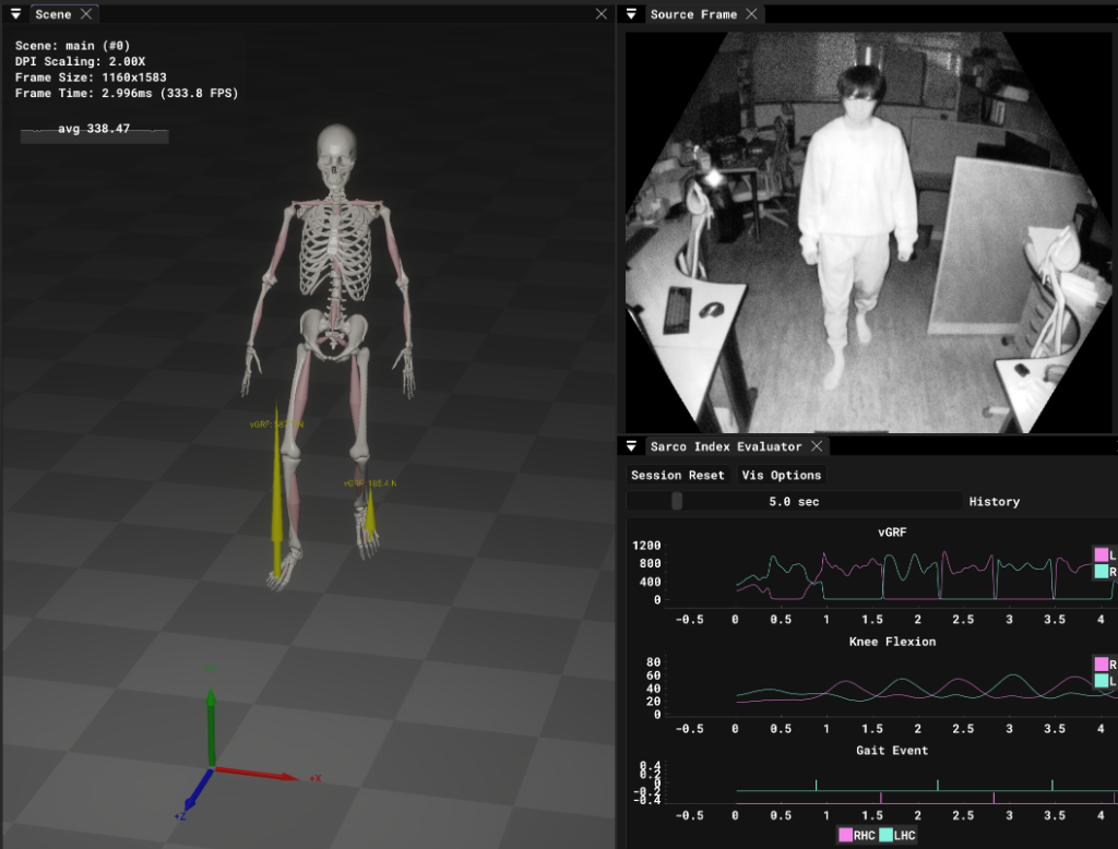 Skeleton Analysis Interface